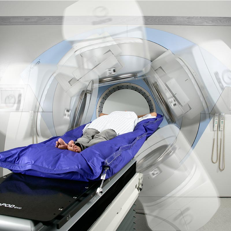 Volumetric Modulated Arc Therapy